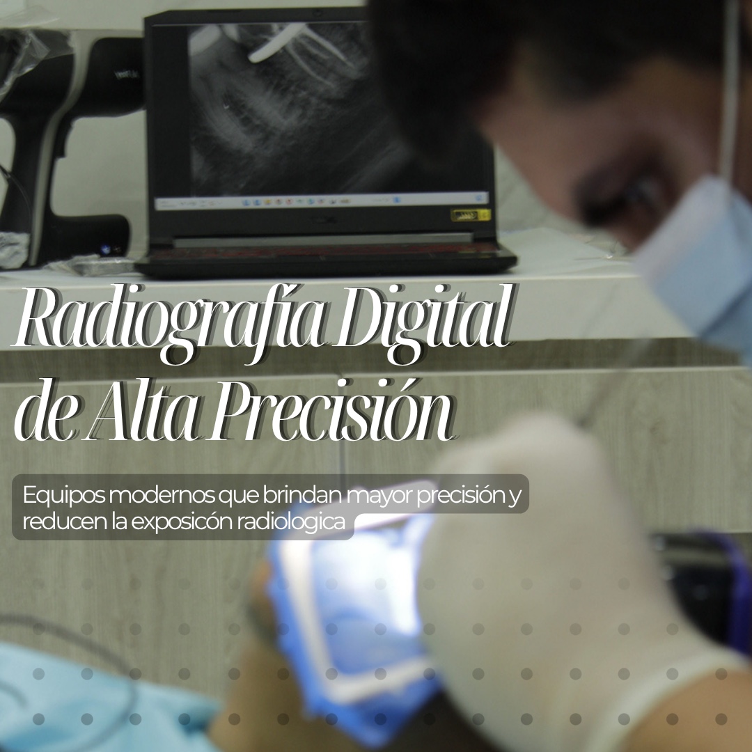 Radiografía digital de alta precisión en MC Grupo Dental